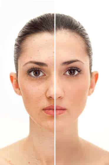 Retouching